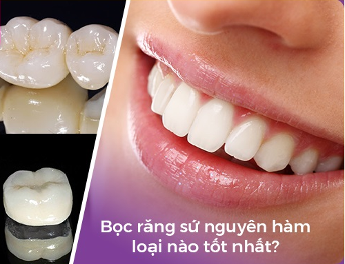Bọc răng sứ nguyên hàm hết bao nhiêu