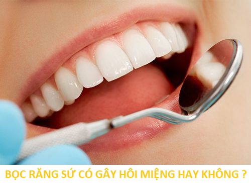 Bọc răng sứ có gây hôi miệng không